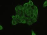 beta Tubulin Antibody in Immunocytochemistry (ICC/IF)