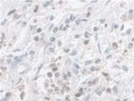 Galectin 9 Antibody in Immunohistochemistry (Paraffin) (IHC (P))