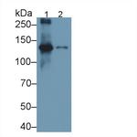 Procollagen I C-Peptide Antibody in Western Blot (WB)