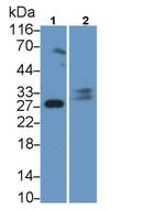 Trypsin Antibody in Western Blot (WB)