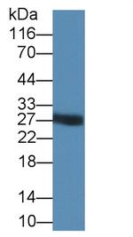 Trypsin Antibody in Western Blot (WB)