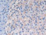 ATF6 Antibody in Immunohistochemistry (Paraffin) (IHC (P))