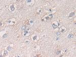 ATF6 Antibody in Immunohistochemistry (Paraffin) (IHC (P))