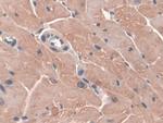 GPX3 Antibody in Immunohistochemistry (Paraffin) (IHC (P))