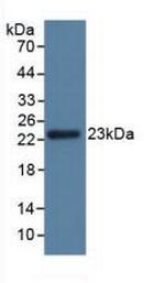 GPX3 Antibody in Western Blot (WB)