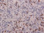 S100A4 Antibody in Immunohistochemistry (Paraffin) (IHC (P))