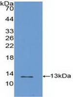 S100A4 Antibody in Western Blot (WB)