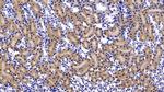 FABP1 Antibody in Immunohistochemistry (Paraffin) (IHC (P))