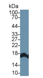 RBP2 Antibody in Western Blot (WB)