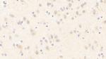 nNOS Antibody in Immunohistochemistry (Paraffin) (IHC (P))