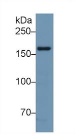 nNOS Antibody in Western Blot (WB)