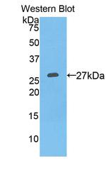 PSA Antibody in Western Blot (WB)