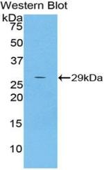 A2ML1 Antibody in Western Blot (WB)