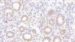 NUP88 Antibody in Immunohistochemistry (Paraffin) (IHC (P))