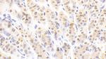 NUP88 Antibody in Immunohistochemistry (Paraffin) (IHC (P))