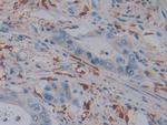 Ferritin Light Chain Antibody in Immunohistochemistry (Paraffin) (IHC (P))