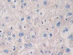 EB1 Antibody in Immunohistochemistry (Paraffin) (IHC (P))