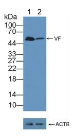 NAMPT Antibody in Western Blot (WB)