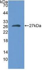 Myosin heavy chain 1 Antibody in Western Blot (WB)