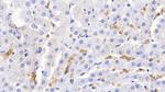 Hemoglobin Antibody in Immunohistochemistry (Paraffin) (IHC (P))