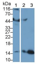 Hemoglobin Antibody in Western Blot (WB)