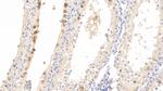 Pleiotrophin Antibody in Immunohistochemistry (Paraffin) (IHC (P))