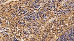 IL13RA2 Antibody in Immunohistochemistry (Paraffin) (IHC (P))