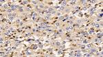 IL13RA2 Antibody in Immunohistochemistry (Paraffin) (IHC (P))