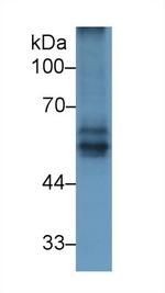 BACE2 Antibody in Western Blot (WB)