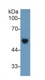 BACE2 Antibody in Western Blot (WB)