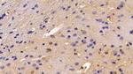 S100B Antibody in Immunohistochemistry (Paraffin) (IHC (P))