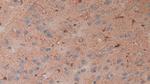 S100B Antibody in Immunohistochemistry (Paraffin) (IHC (P))