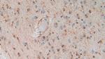 S100B Antibody in Immunohistochemistry (Paraffin) (IHC (P))