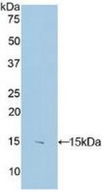 S100B Antibody in Western Blot (WB)