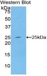 Alcohol Dehydrogenase 1A Antibody in Western Blot (WB)