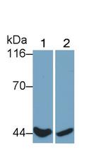 CD64 Antibody in Western Blot (WB)