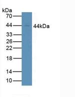 CD64 Antibody in Western Blot (WB)