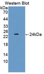 PEBP1 Antibody in Western Blot (WB)