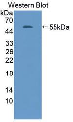 Adiponectin Antibody in Western Blot (WB)