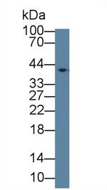 ABHD7 Antibody in Western Blot (WB)