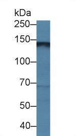 HEPH Antibody in Western Blot (WB)