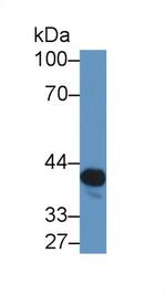 NAT2 Antibody in Western Blot (WB)