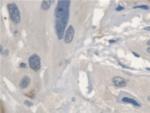 SERPINB3/SERPINB4 Antibody in Immunohistochemistry (Paraffin) (IHC (P))