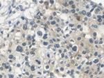 SERPINB3/SERPINB4 Antibody in Immunohistochemistry (Paraffin) (IHC (P))