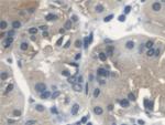 SERPINB3/SERPINB4 Antibody in Immunohistochemistry (Paraffin) (IHC (P))