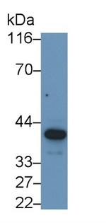 SERPINB3/SERPINB4 Antibody in Western Blot (WB)