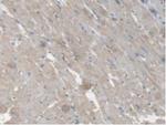 CES1 Antibody in Immunohistochemistry (Paraffin) (IHC (P))