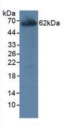 CES1 Antibody in Western Blot (WB)