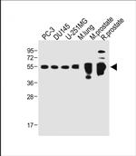 Prostate Specific Acid Phosphatase Antibody in Western Blot (WB)