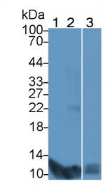 S100A7 Antibody in Western Blot (WB)